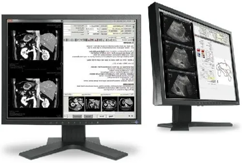 (MX194) MONITOR (จอคอมพิวเตอร์) EIZO RadiForce MX19419.0" VA 5:4 2000:1 1280 x 1024 - Image 3